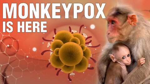 The world's first MONKEYPOX QUARANTINE