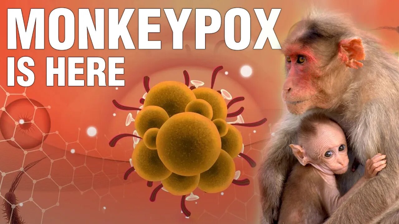 The world's first MONKEYPOX QUARANTINE