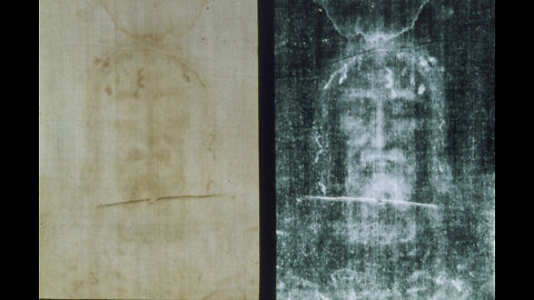 The RH Negative Blood Type: The Shroud