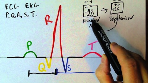 P,Q,R,S,T waves in the EKG