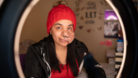 I'll Never Get Surgery - I Embrace My Face | SHAKE MY BEAUTY