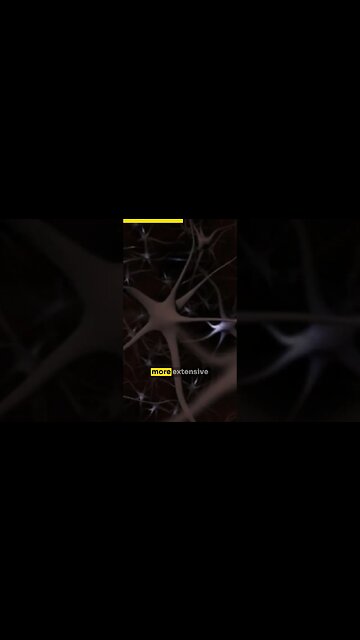 How to train for a better placebo effect. #neuroscience