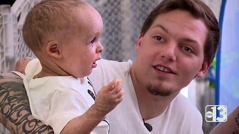 Salve of salvation: Cannabis oil cream gives new hope to Baby Carter