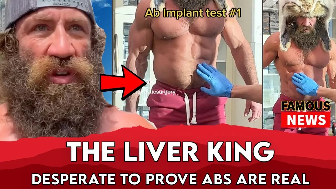 Does The L1ver King Have Ab Implants? | Famous News