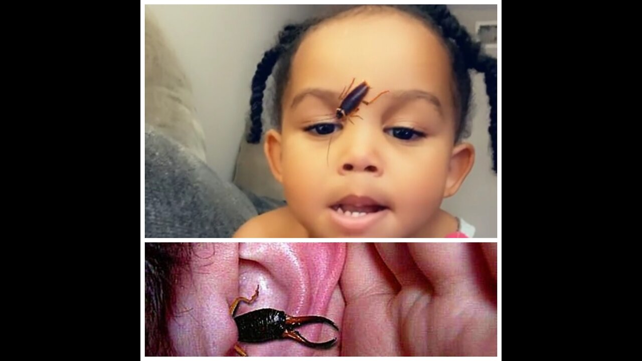 A Cockroach Got Into A Child's Nose ,🤭🤔😭😱