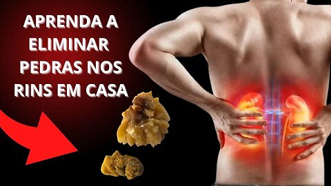 REMÉDIOS NATURAIS PARA ELIMINAR AS PEDRAS NOS RINS RÁPIDO EM CASA