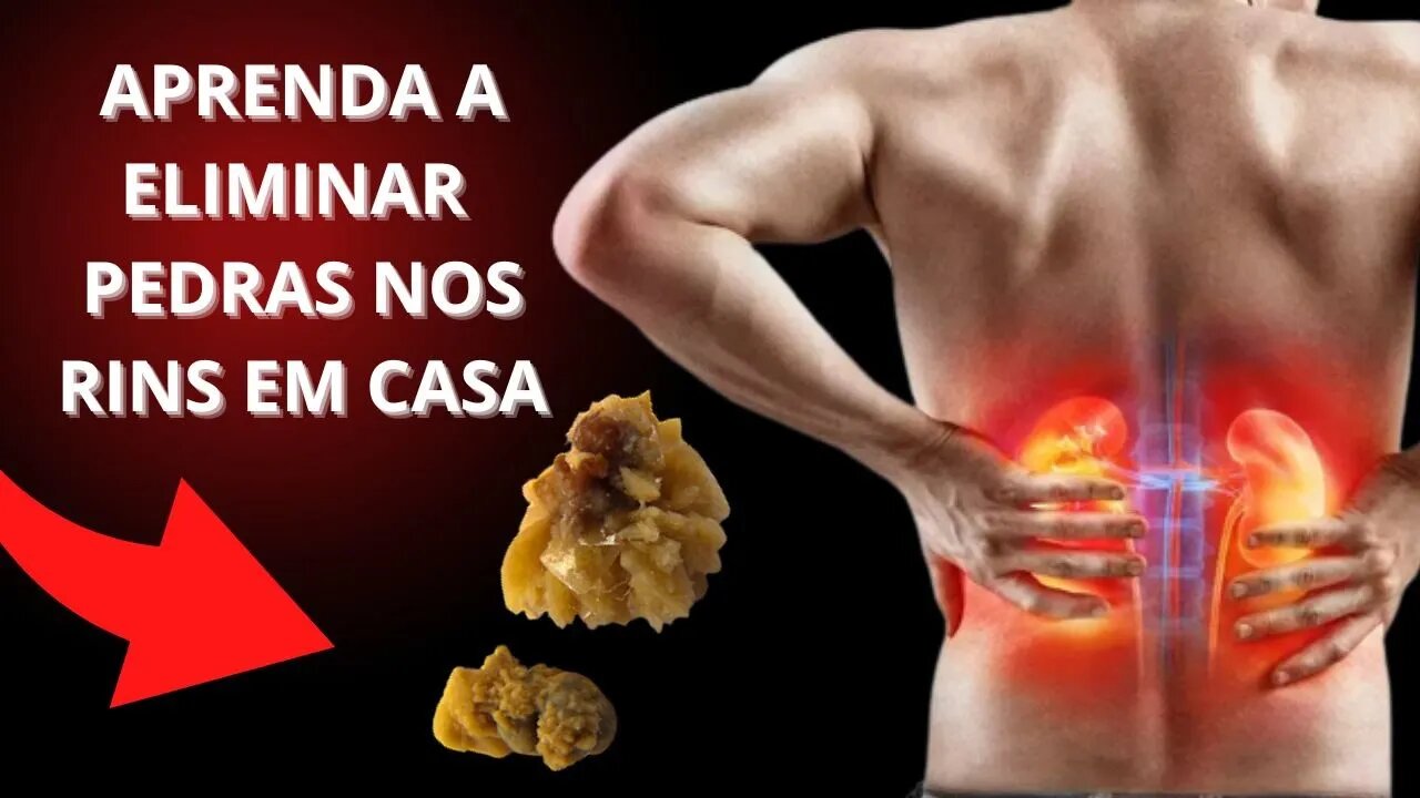 REMÉDIOS NATURAIS PARA ELIMINAR AS PEDRAS NOS RINS RÁPIDO EM CASA