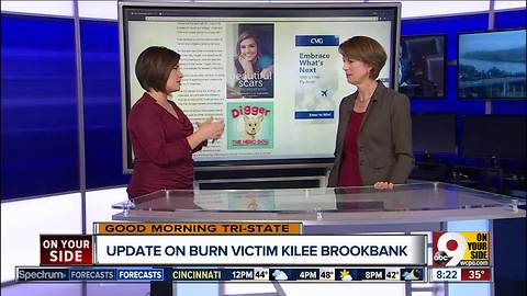 Update on burn victim Kilee Brookbank