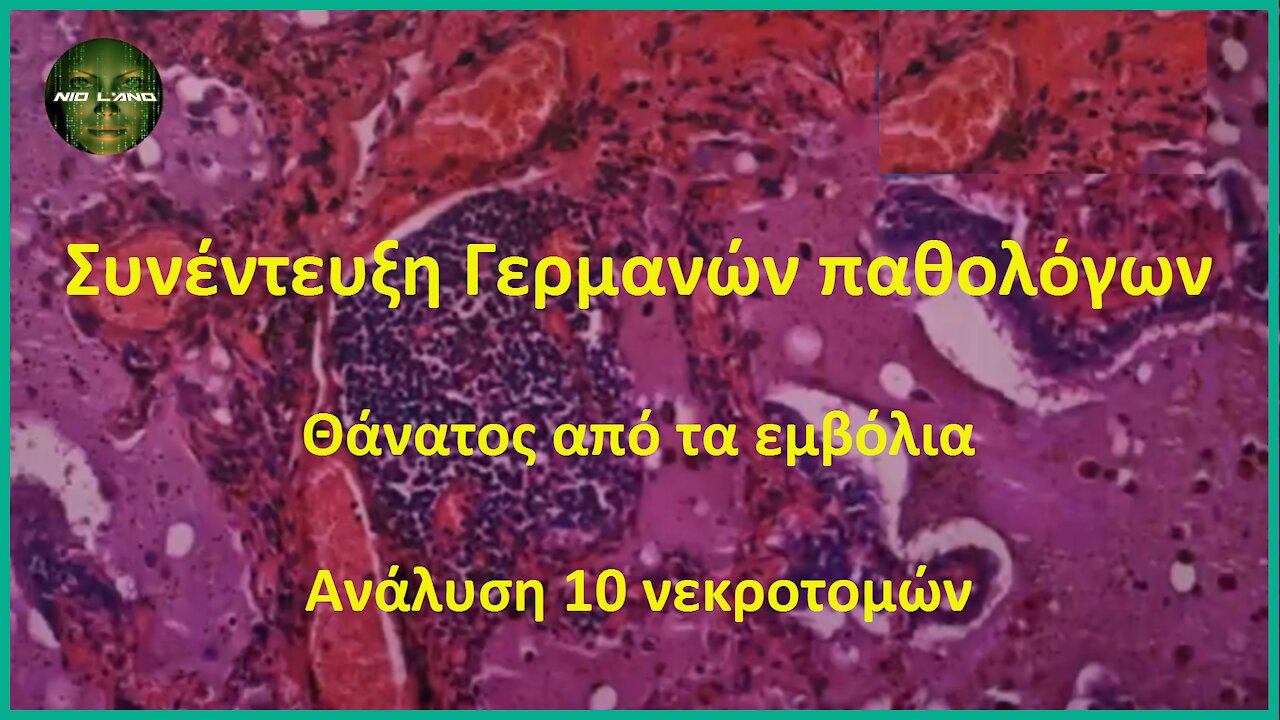 Συνέντευξη τύπου Γερμανών παθολόγων | Θάνατος από τα εμβόλια | Ανάλυση 10 νεκροτομών (στα Ελληνικά)