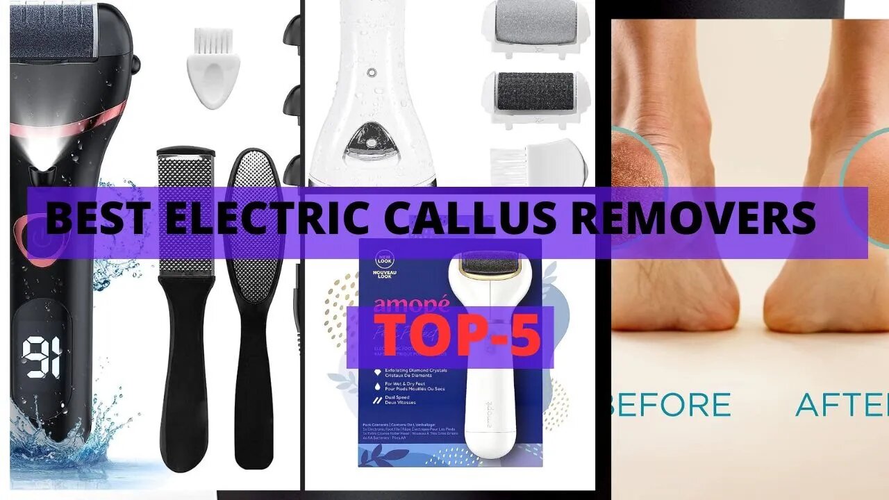 Best Electric Callus Removers that can Transform Your Feet