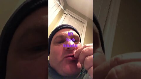 DIY tooth extractor