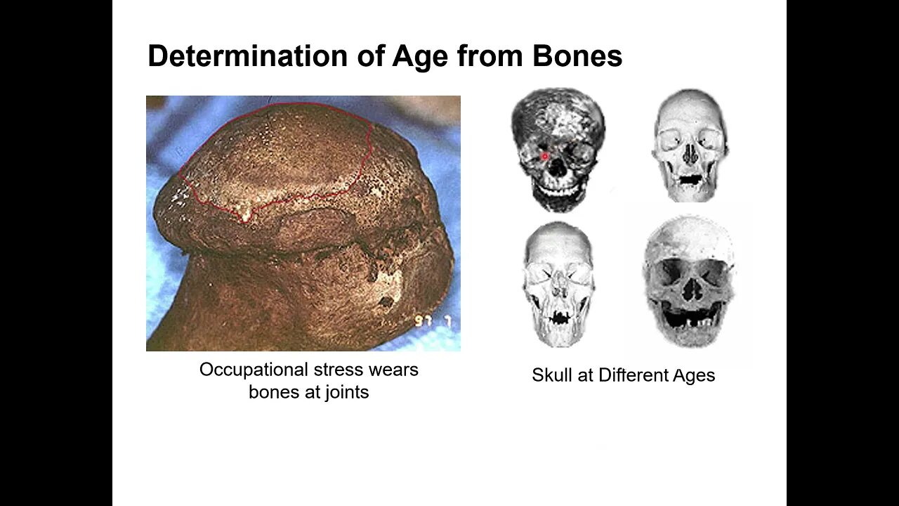 Working as a Forensic Anthropologist