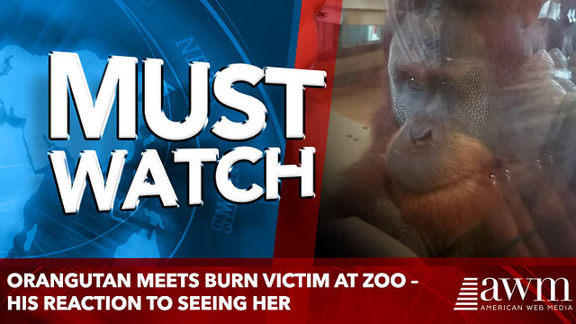 Orangutan meets burn victim at zoo – His reaction to seeing her