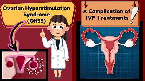 Ovarian Hyperstimulation Syndrome (OHSS) | A Complication of In Vitro Fertilization (IVF) |Explained