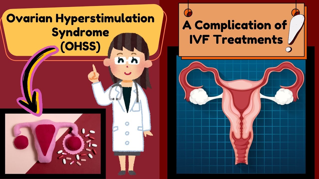 Ovarian Hyperstimulation Syndrome (OHSS) | A Complication of In Vitro Fertilization (IVF) |Explained