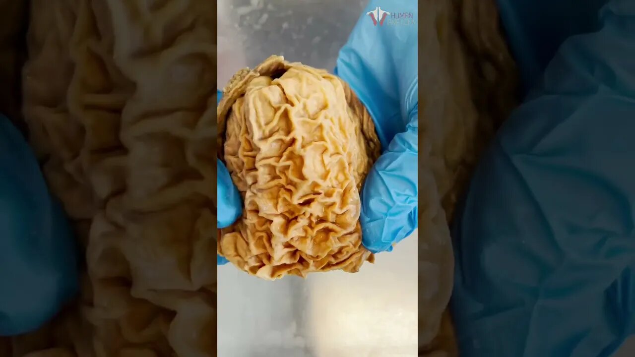 Looking Inside a Real Human Stomach | #shorts #food