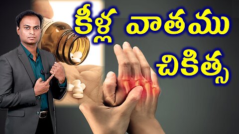 కీళ్ల వాతంకి చికిత్స | Advantages of Homeopathy in Treating Rheumatoid Arthritis Treatment and Cure