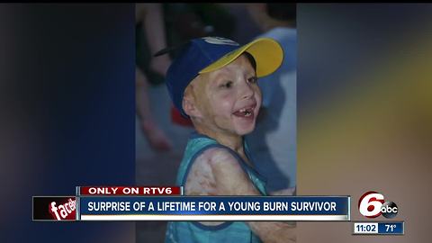 Burn survivor get special surprise at Colts game