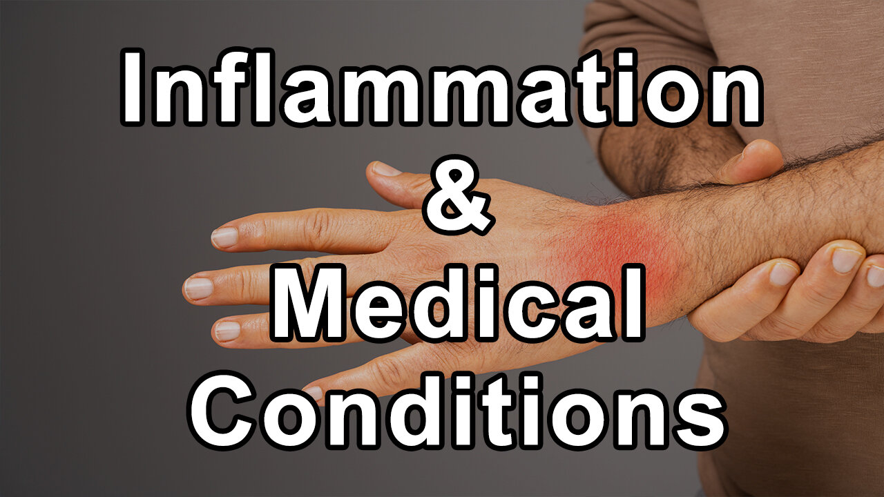 Dr. Jyothi Rao Discusses Why Inflammation Is Crucial As It Plays a Role in Numerous Medical