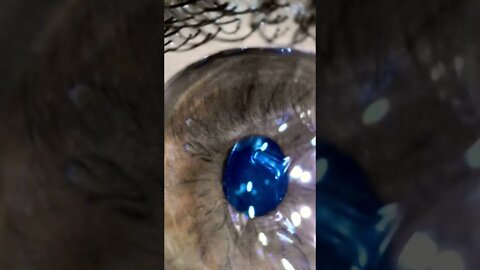 An eye under a microscope 🔬