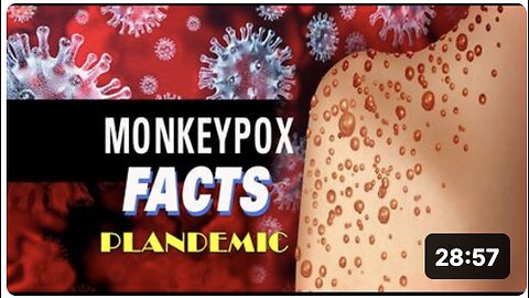 The Truth About The Monkey Pox (Mpox) Plandemic