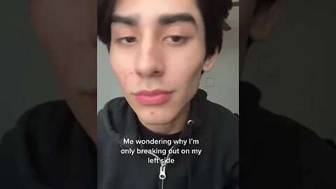 Me Wondering Why I'm Only Breaking Out On My Left Side Video By Guyw1thbraces #Shorts