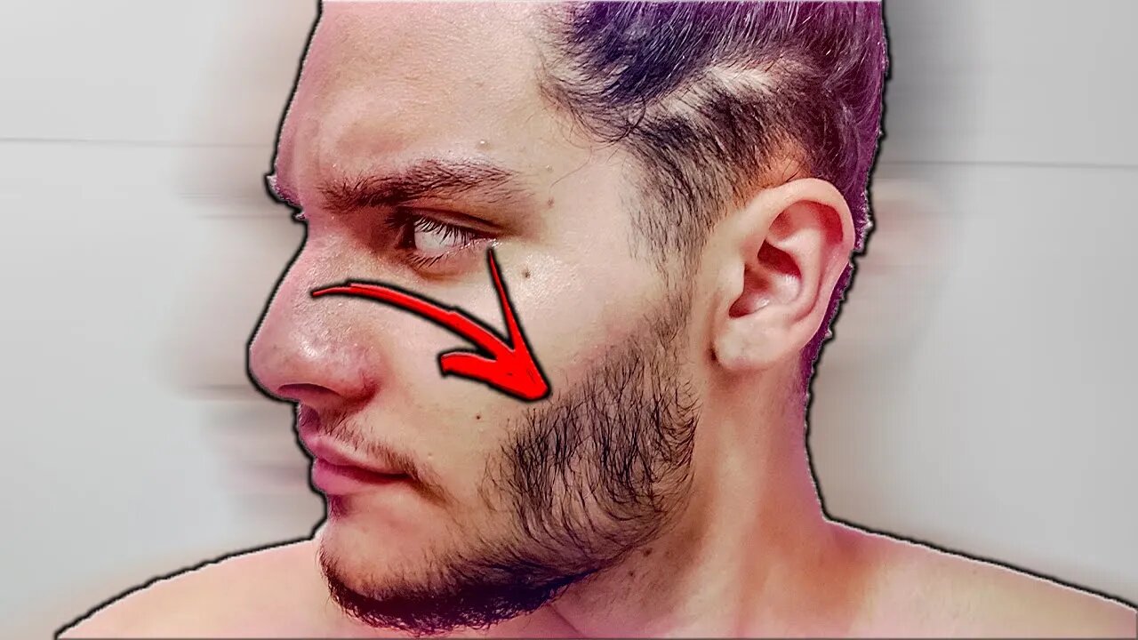 COMO PASSAR MINOXIDIL CORRETAMENTE PARA A BARBA CRESCER ✅️🔥