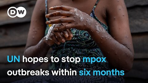 With deadlier mpox strain spreading in Central Africa, what's holding up vaccinations ? | DW News