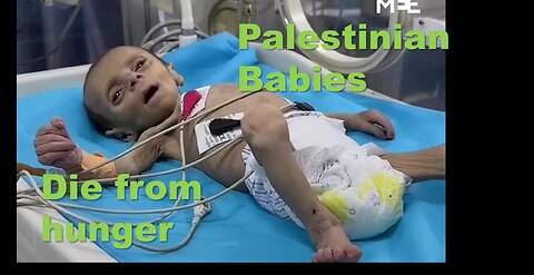 Palestinian Babies dying from hunger