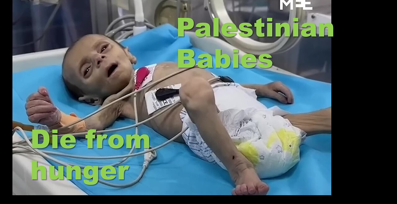Palestinian Babies dying from hunger