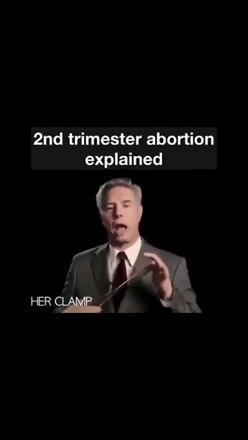 Is this what you mean by Abortion? Please share