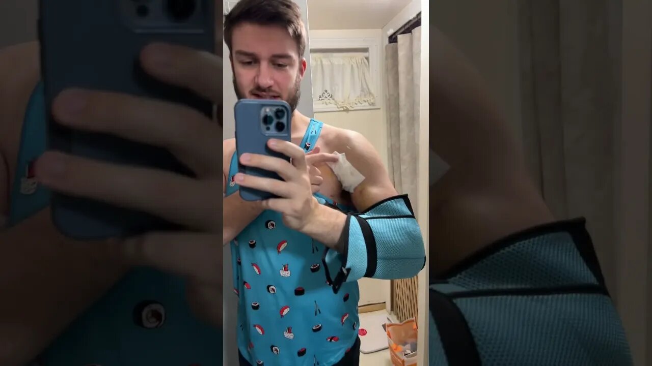 Post Pec Tear Surgery Update - Third Times a Charm!