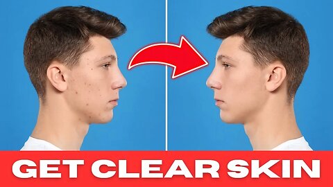 Want Acne-Free Skin? Try This Powerful Juice Recipe!
