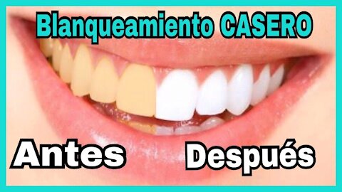 😁😂COMO TENER DIENTES BLANCOS EN 3 MINUTOS