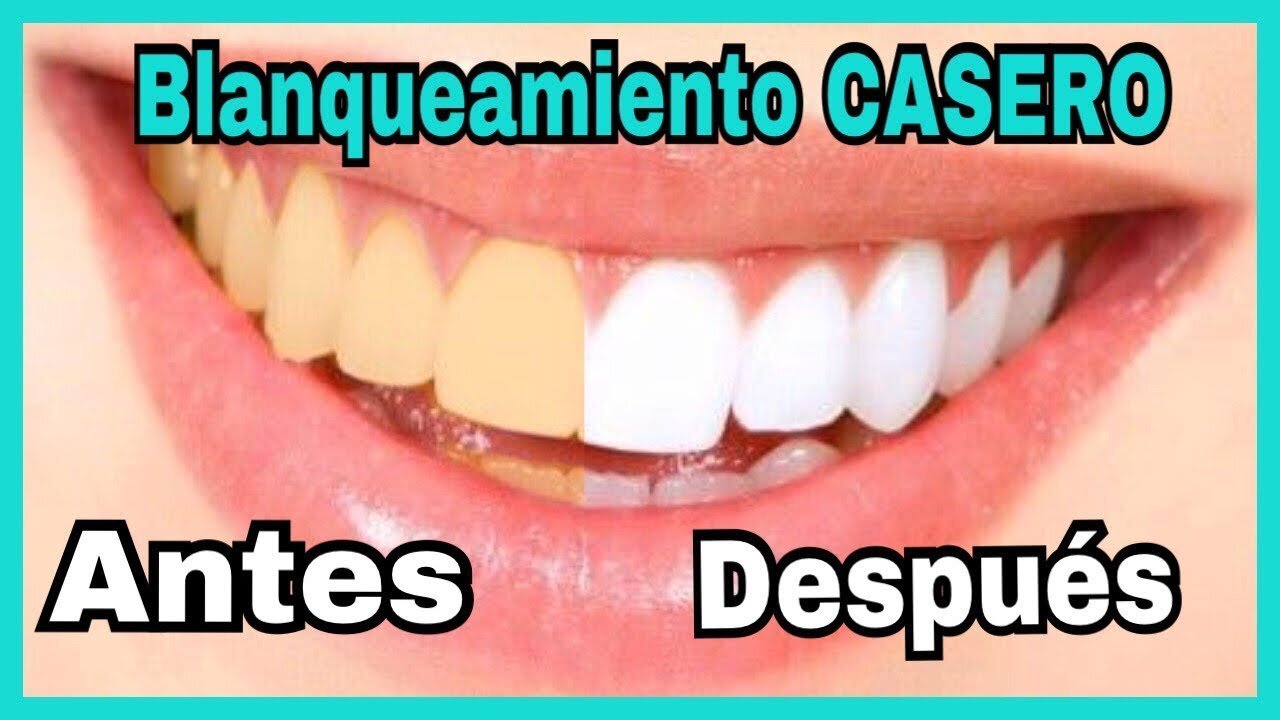 😁😂COMO TENER DIENTES BLANCOS EN 3 MINUTOS