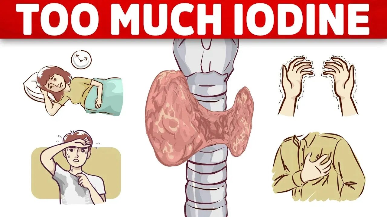 The #1 Sign of Iodine Overload (TOXICITY)