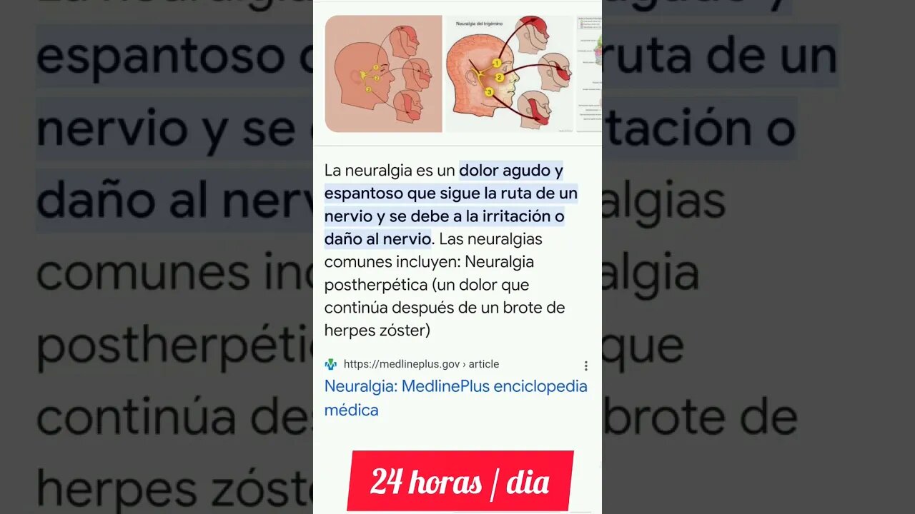 Neuralgia en Piernas / TitoJuan