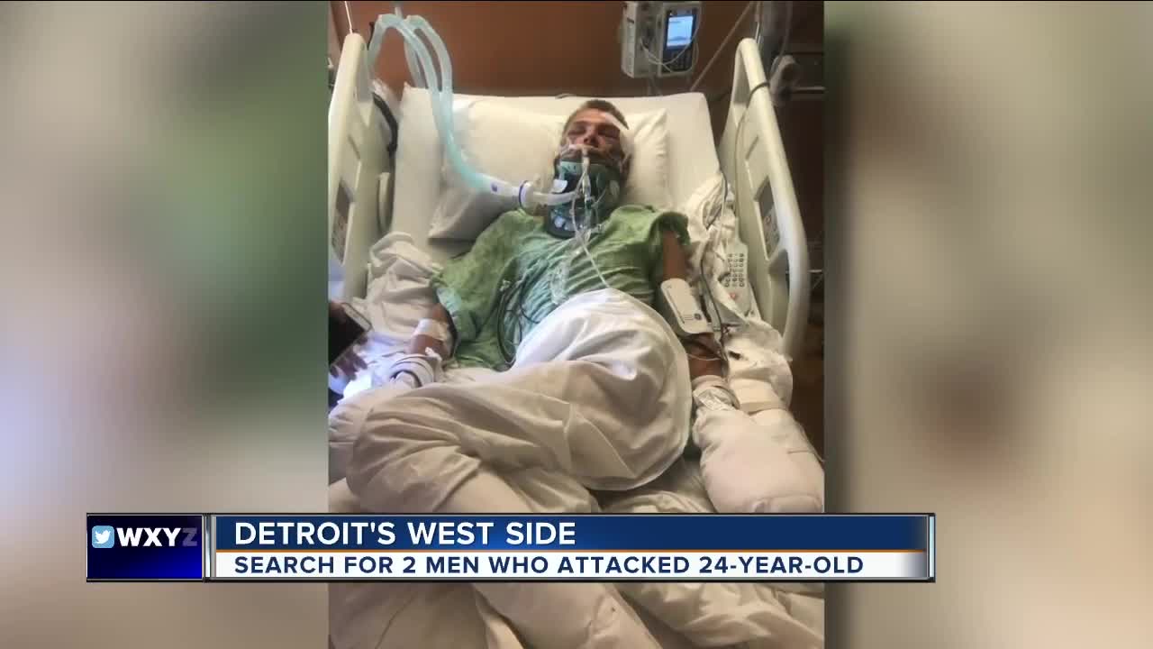 Detroit police searching for 2 suspects who attacked 24-year-old man