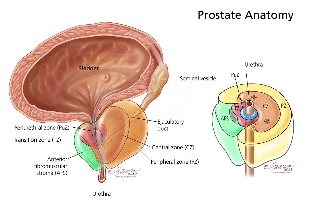 10 Warning Signs of Prostate Cancer