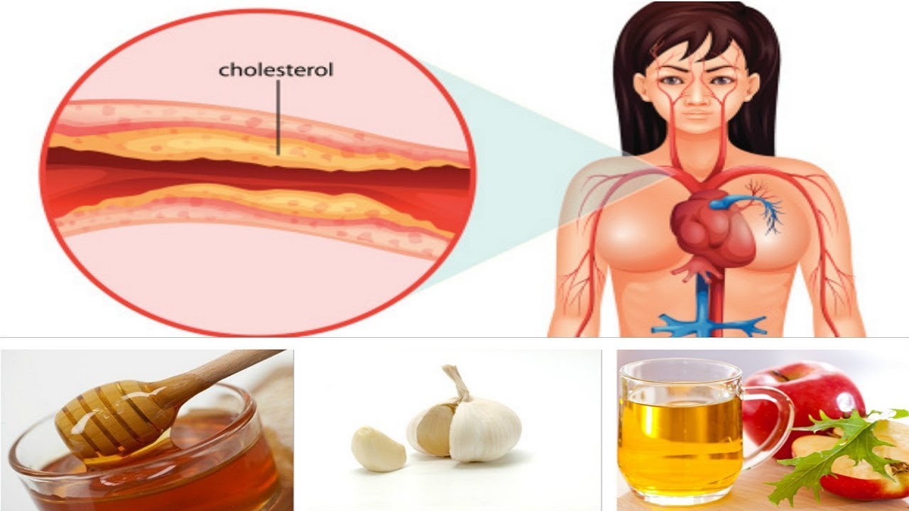 Here is The Best Medicine Against High Blood Pressure and Cholesterol