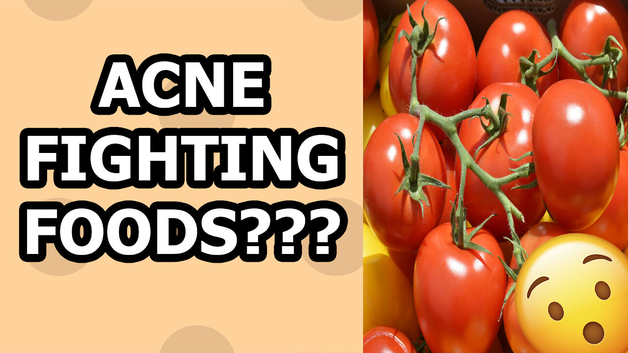 Best Acne Fighting Foods!!