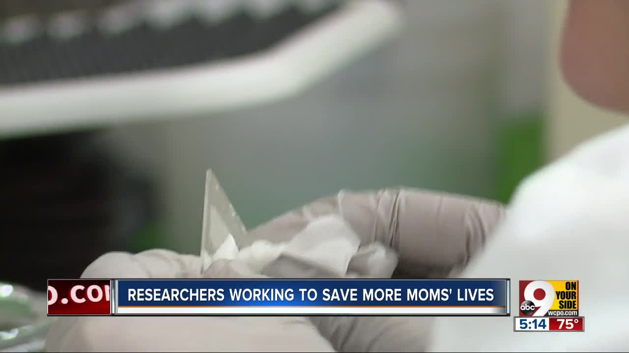 How Cincinnati Children's is working to save more moms