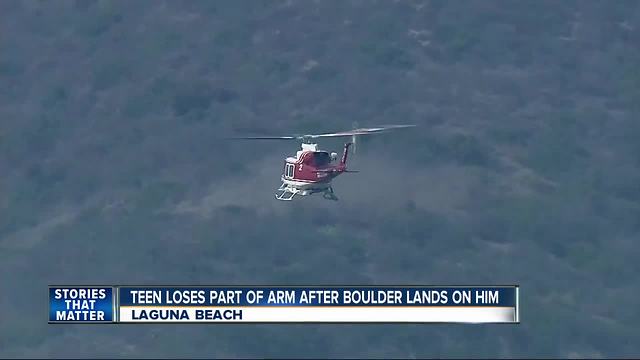 Teen loses part of arm after boulder lands on it in Laguna Beach