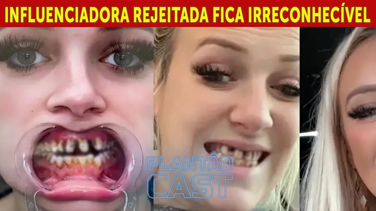 Influenciadora 'rejeitada' por seus dentes tortos mostra o antes e depois em processo espetacular