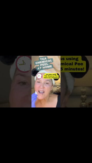 Chemical Peel At Home: WARNING - Results MAY BE UNcomfortable (TYPO: PEEL not PEE 😂)