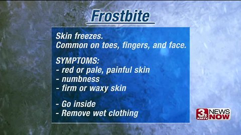 Doctor discusses protecting yourself from frostbite, hypothermia