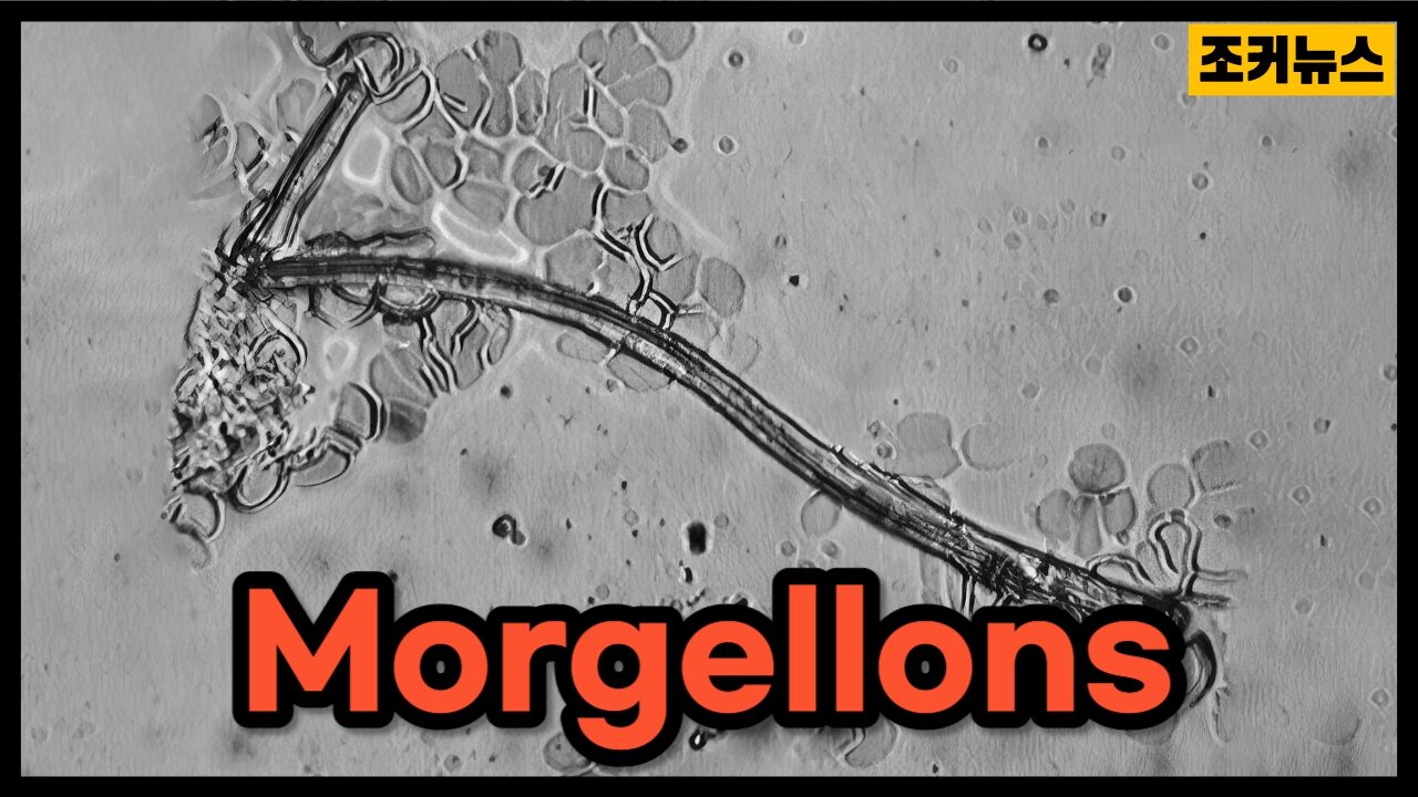 호흡에 반응하는 모겔론스 Morgellons that respond to breathing