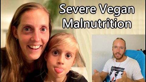 Vegan Doctor Promotes Severe Malnutrition for Children