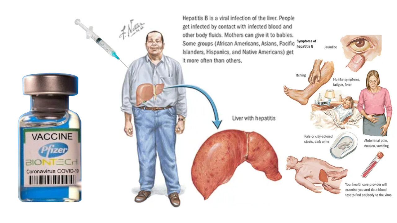 COVID-19 vaccines cause severe Hepatitis in children