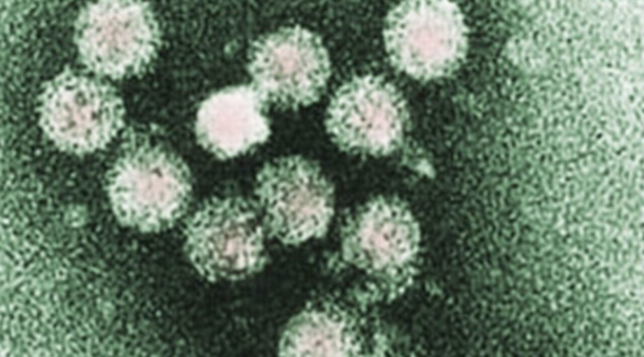 New cases of hepatitis A in Palm Beach County, bringing total to 23 this year